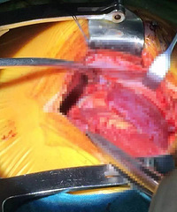 ���ţ�2����ͯ���Լ�����һǹ 5���׶���ֱ������С��