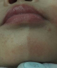 ������ҽ����������͸�������ʲô��������