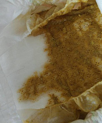 ��ҽ����Ů������һ���������죬���緢�ֱ�