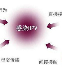 香港打HPV疫苗的好处有哪些?
