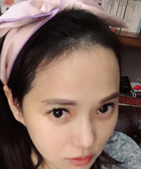 "产后严重脱发的伊能静,如今头上成了这样"