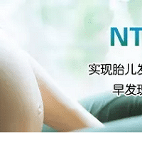 "NT检查,孕早期必做的检查项目之一,孕妈一定要重视!"