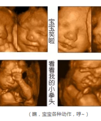 "单胎双胎的孕妈看过来,四维彩超检查预约攻略!"