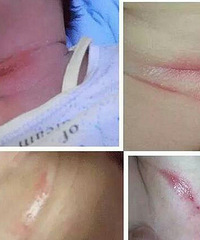 "新生儿莫名其妙大哭?可能因为脖子淹了我"