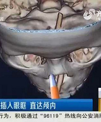 ��ͯˤ���������Ӳ����ǻ ��1���״�������