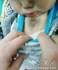 ����˳�������Ѫ������������Ǯ��  ���Ѻ�:��С��վס��