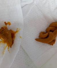 ������ǲ���