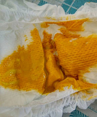 ��ҽ����ã���ʮ�����С�����������Ĵ��