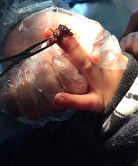 �Ƶ��ͯ���ΰ��Һ�����Ū������ �п��ܻỵ�£�