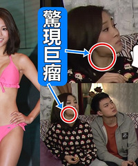 "前港姐颈部惊现巨瘤!随剧集播出越长越大(图)"