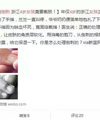 "4岁女孩因为拔倒刺竟要截肢,宝宝手上的倒刺该怎么护理?%u00a"
