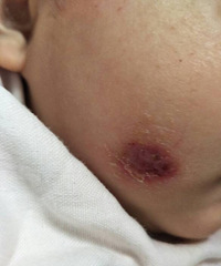 ����Ѫ������