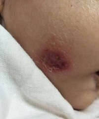 ����Ѫ������