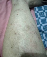 ��ҽ����ã�����ֻС����࣬һ������ʹ�