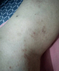 ��ҽ����ã�����ֻС����࣬һ������ʹ�