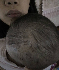 ����ʪ�����Ƿ�������ô�죿