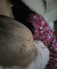 ����ʪ�����Ƿ�������ô�죿