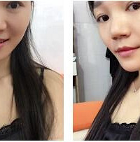 姐妹们来看看我的鼻子看起来自然吗?