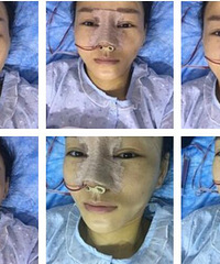 �������������ҵı��ӿ�������Ȼ��