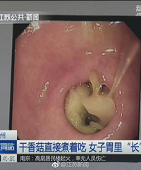 "吓人!干香菇直接煮着吃 大妈胃里长出完整香菇"