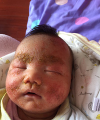 �����֬����Ƥ��