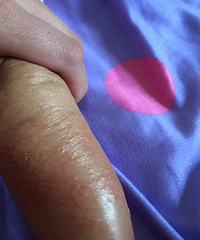 ���������������֬����Ƥ�ף�����ˮ ����