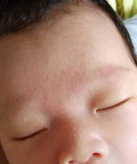 ��ҽ��������ʪ����