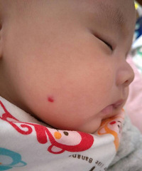 ҽ�������Ҷ�����ô��