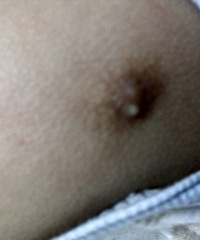 ��ҽ����ã�80�����СŮ������ͷ���ϳ�