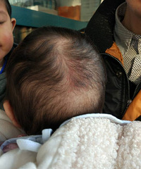 ��ҽ����3����Ů�����Է���ԭ��