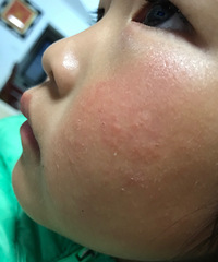 ��ҽ������æ��һ����