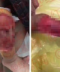 8�´���Ӥ��3���㱻������������ҧ��