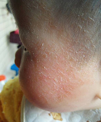 ��ҽ�����ҿ���