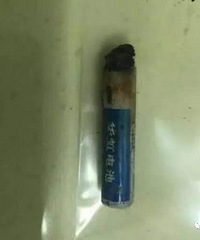 "惊心!五岁女孩阴道内取出7号电池!宝宝常"
