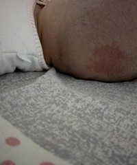 ����ͷ����̥�ǣ�����Ѫ������