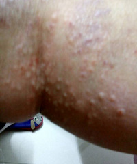 ��ҽ����ã�������ʲôѽ��������һ��һ��