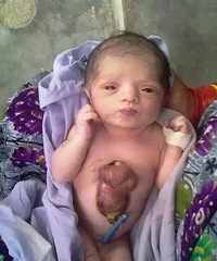 ŮӤ����ʱ���೤���⸸ĸ�� 800��Ӥ���в���1��