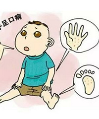 "手足口病疫苗,打还是不打?手足口病,"