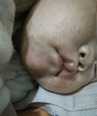 ���ҽ����ʪ�����ô�죿