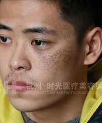 梳着背头、笑容自信的小伙子真认不出是“熊猫眼”小楼了