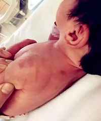 "婴儿身上多处淤紫竟是奶奶下的手 原因很荒"