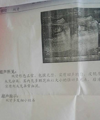 @不玩就老了,请帮我看下这个肾上有芝麻大