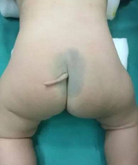 "香菇!宝宝出生时有根尾巴。。。"