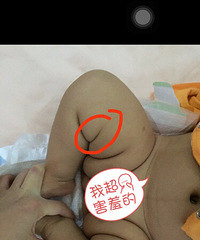 ��ҽ�������Ǽұ������Źؽڳ���������