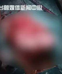 "12岁女孩肚子大如孕妇 检查发现为卵巢癌"