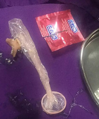 "不小心把带钩的假牙吞进肚子……医生竟然往她嘴里塞了个避孕套!