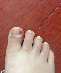 ��������Ǽ׹����𣿻��ڲ�����Ҫ��ôŪ��