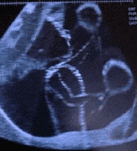 ʵ�ģ������Լ�����ĸ�� �𺳰�����