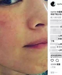 "女生舒淇都过敏了!杭州这个天气请注意:防晒!防晒!防晒"