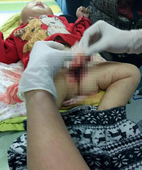 һ����4���´����ͯ���Լ�С��ҧ����С������